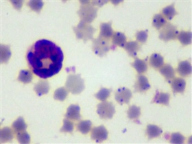 Glóbulos rojos bovinos infectados con Anaplasma marginale.