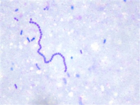 Estreptococos sp. en Leche