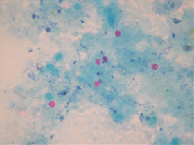 Coloración de Ziehl Neelsen modificada - Ooquistes de Cryptosporidium