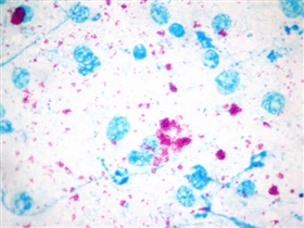 Coloración de Ziehl Neelsen Mycobaterium paratuberculosis