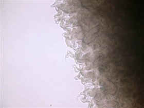 Borde de Colonia en cabeza de meduza (Bacillus Anthracis)