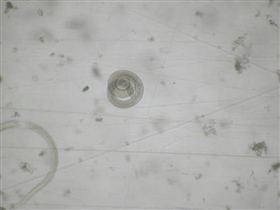 Larvas de Trichinella spiralis